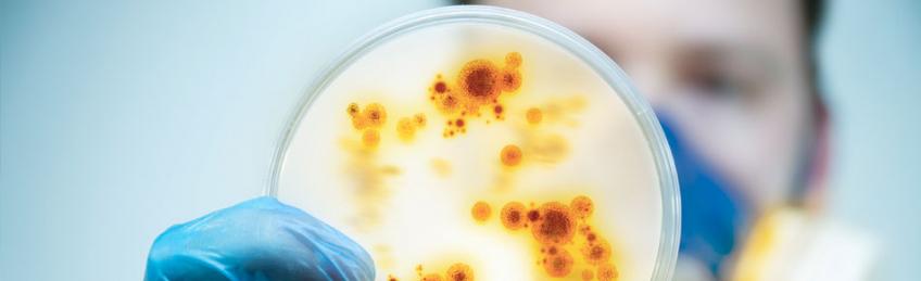 Microbiological Analysis